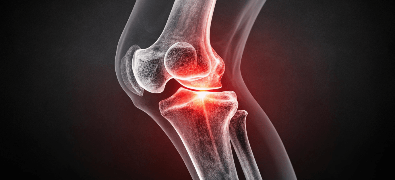 collagen joints tendors.png